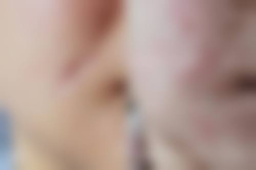 刘炜娟医生的个性化方案定制