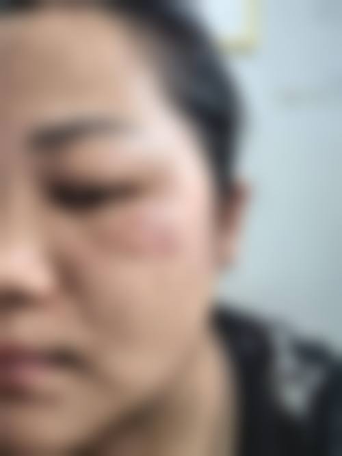 包头刘恕整形医疗美容诊所怎么样特色项目及技术优势