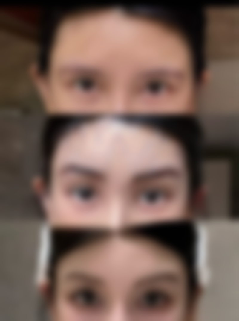 武汉大麦微针植发求美者反馈