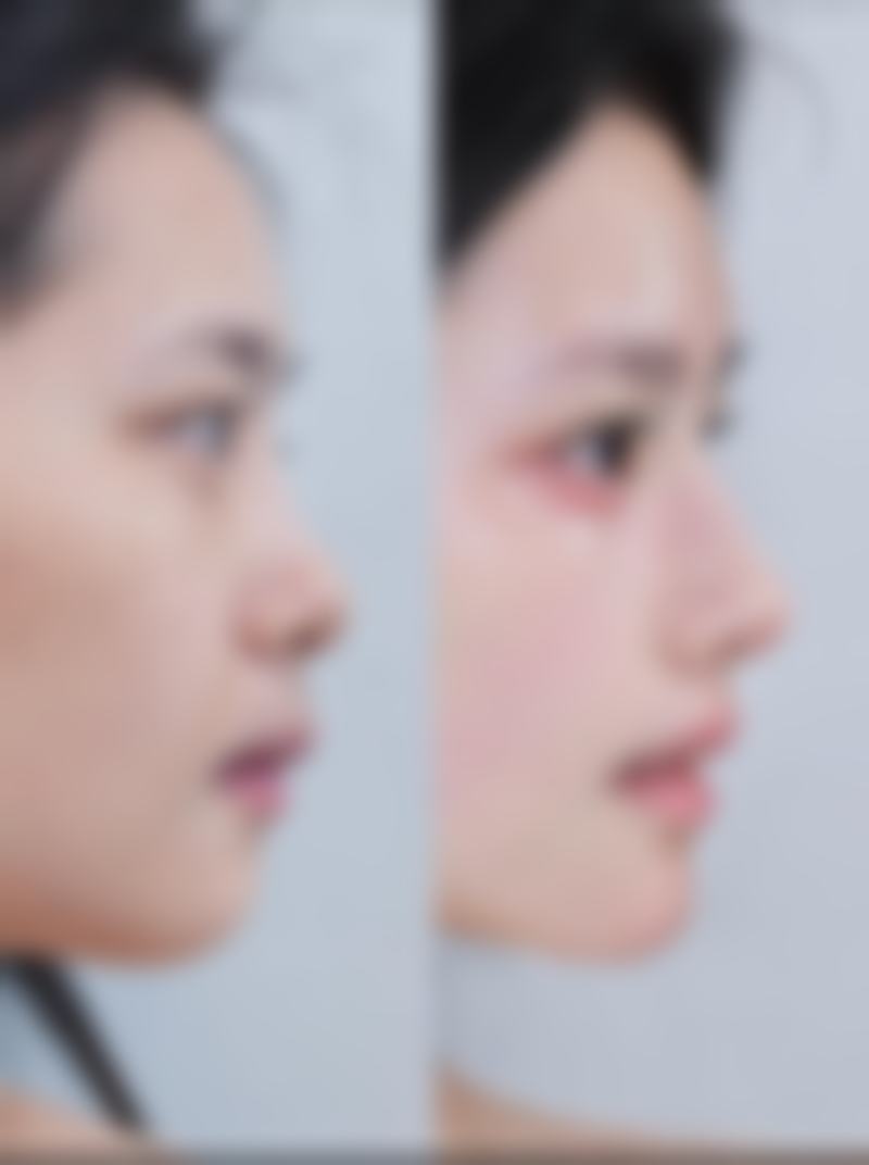 广西熠美医疗美容医院有限公司南宁医疗美容门诊部怎么样价格收费