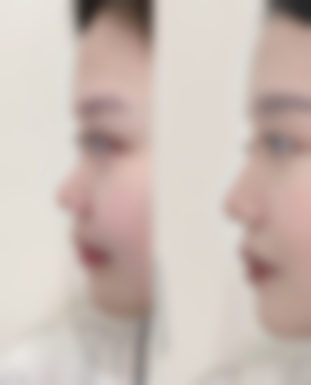 广西熠美医疗美容医院有限公司南宁医疗美容门诊部怎么样来院路线