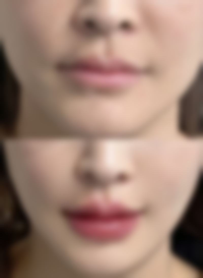 汉中3201医院医学整形美容科价格收费