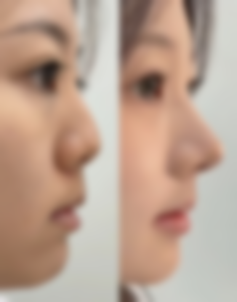 广西熠美医疗美容医院有限公司南宁医疗美容门诊部怎么样简介概述