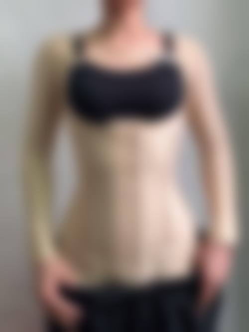 杨德琼医生的吸脂减肥个性化定制