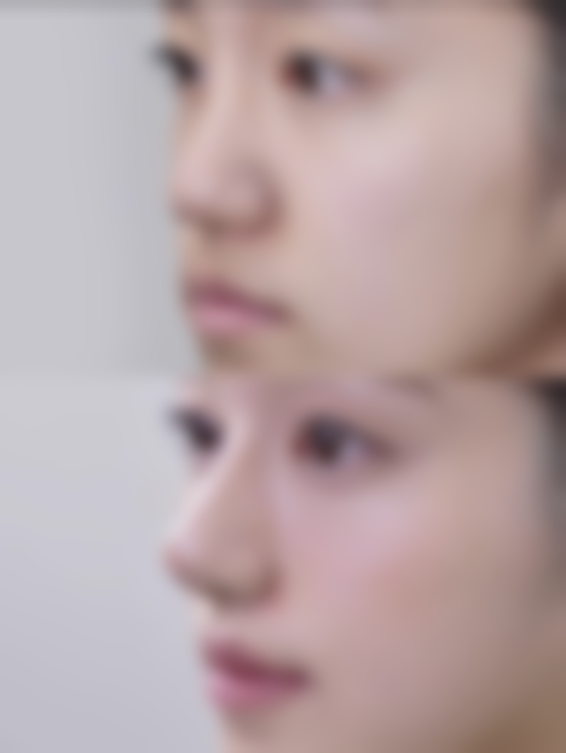 屈平安医生的擅长领域