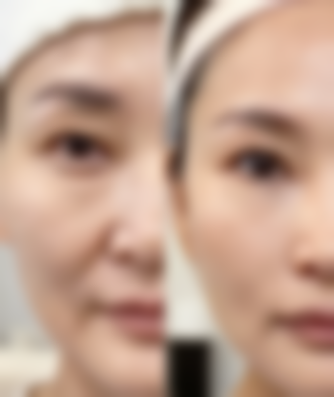 选择屈平安医生的重要意义