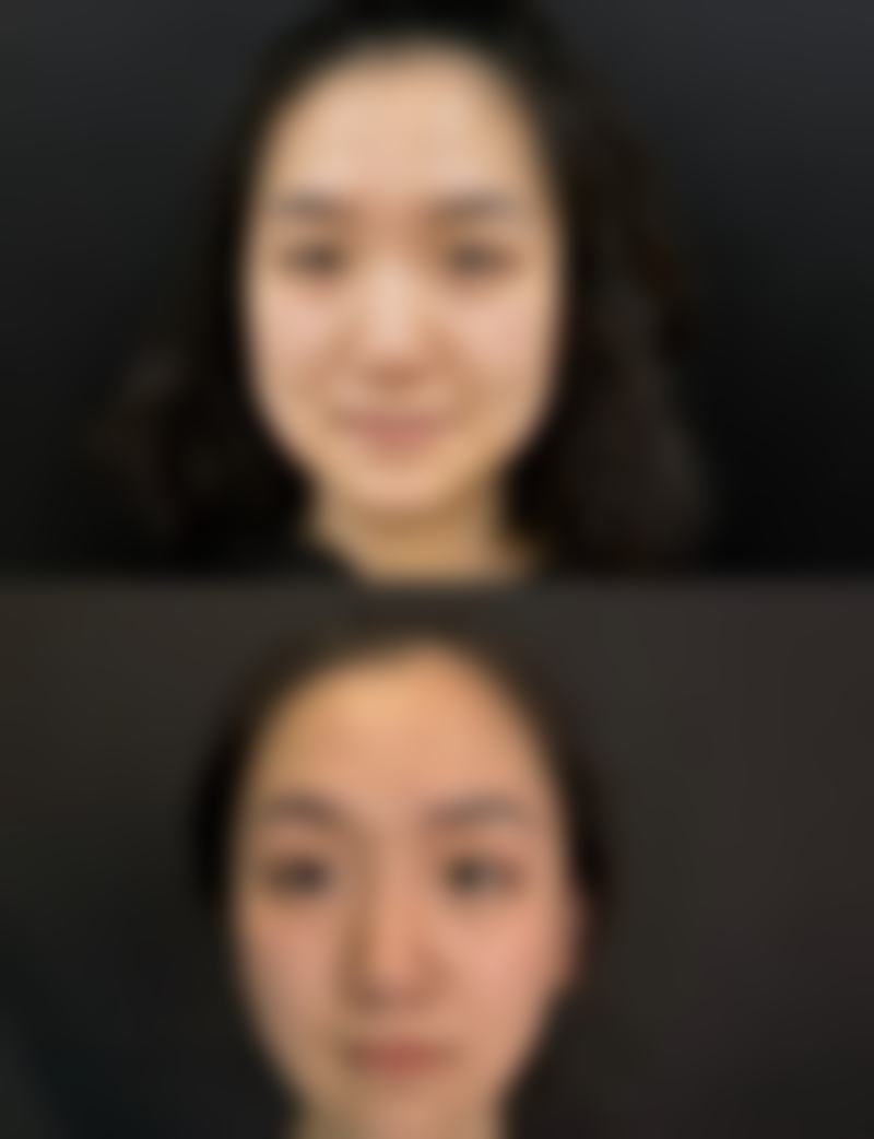 选择杨德琼医生开启美丽之旅