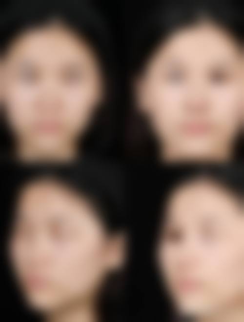 李梅医生的成功实例见证实力