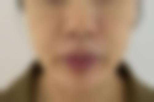 李广智医生带来的美丽保护