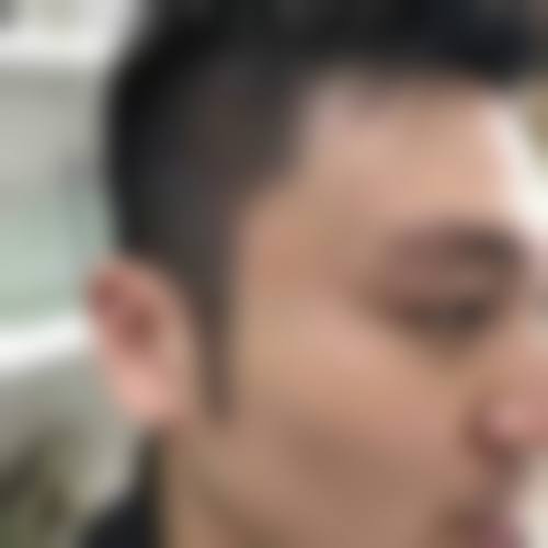 武汉武总华科植发专科医院求美者反馈