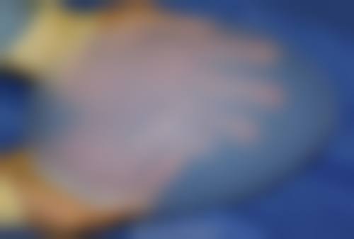 精良设备助力黄亮谊医生精细治疗