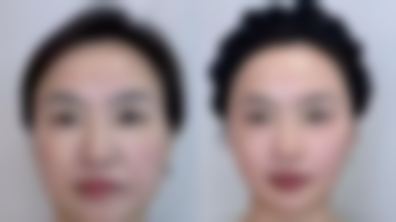 李广智医生所在医院的合理收费