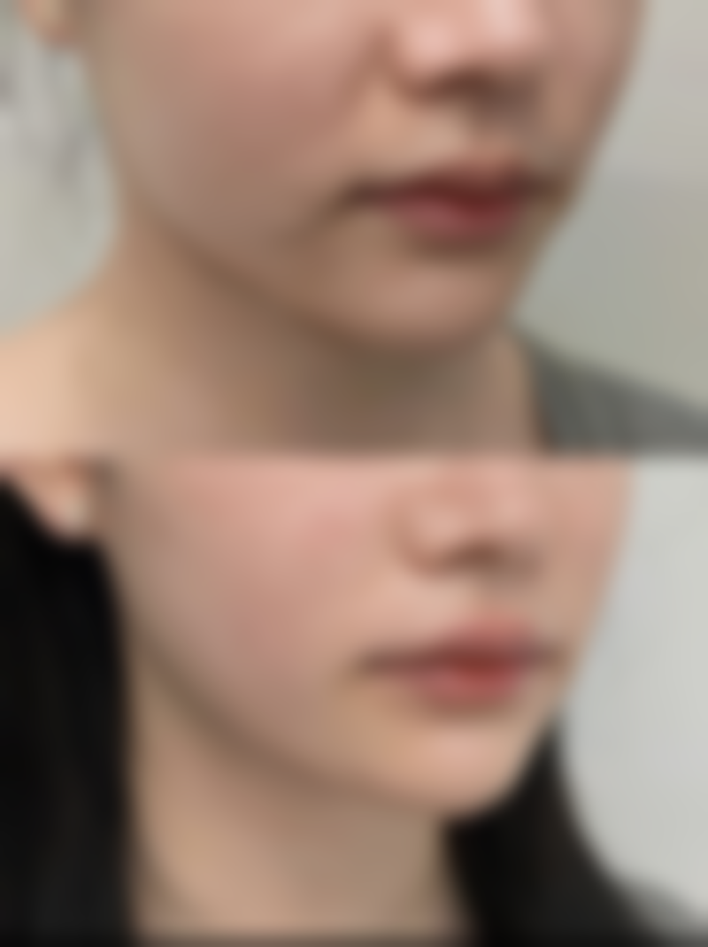 威海孙漫整形美容医院怎么样价格收费