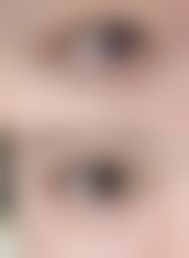 青岛熙朵医疗美容整形医院求美者反馈