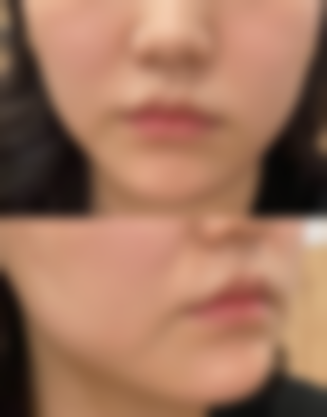 聊城欧莱美容医院求美者反馈