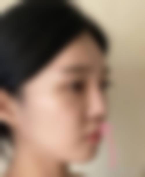 长沙贝美医疗美容怎么样求美者反馈