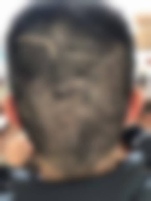 盐城艺植植发诊所怎么样求美者反馈