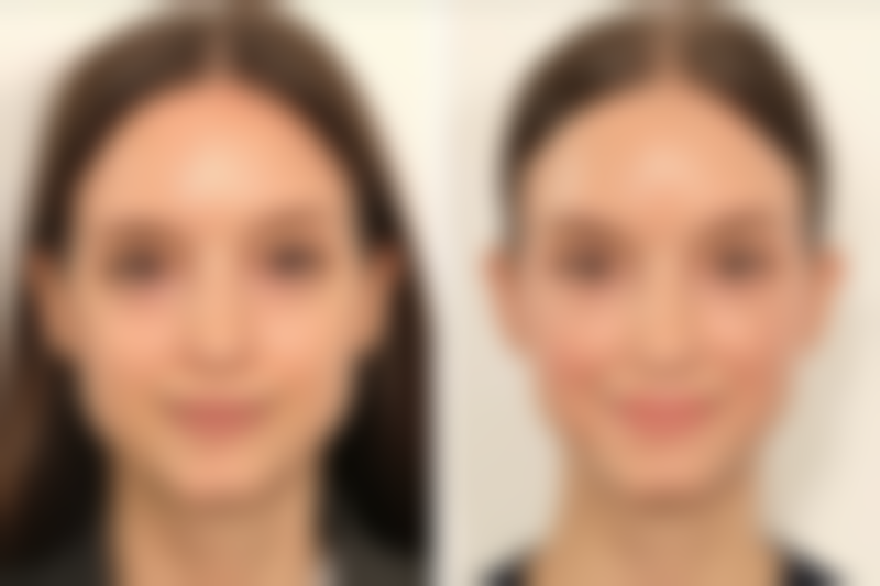 曾伟荣医生的学术追求与荣誉