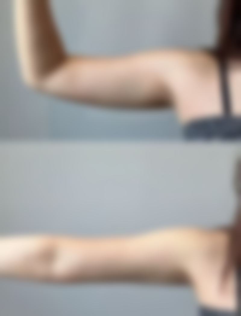 Dione Lee 医生的技术优势