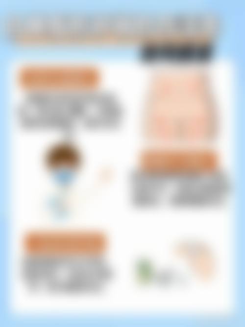 史迎军 医生的技术优势