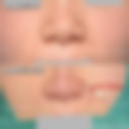 鸡西Dr.W王医生整形医院求美者反馈