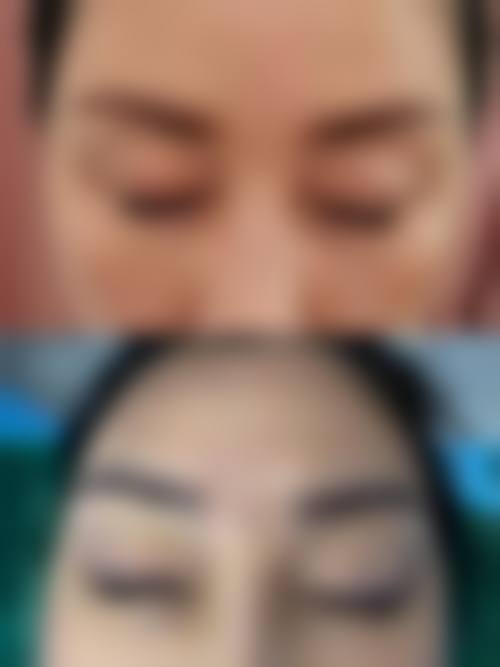 深圳新生植发求美者反馈