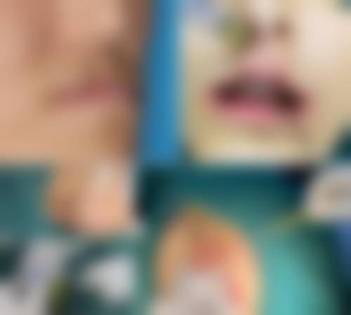 郑美善医生的价格优势