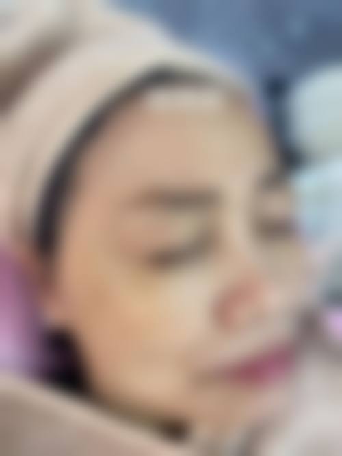 中山爱思特医疗美容整形医院怎么样特色项目及技术优势