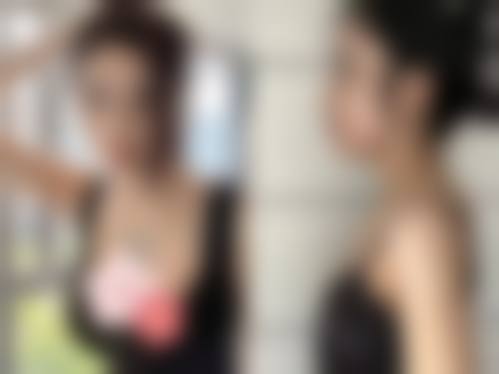 中山爱思特医疗美容整形医院怎么样医生团队实力