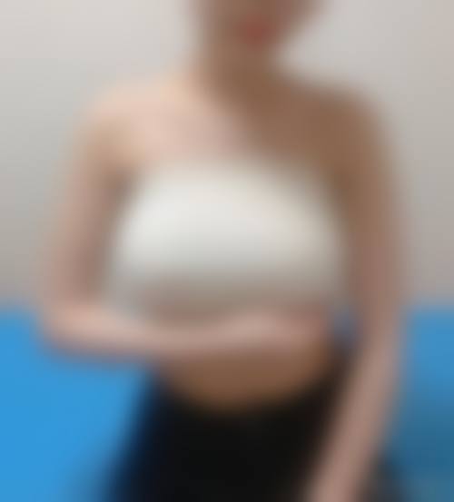 中山爱思特医疗美容整形医院怎么样求美者反馈