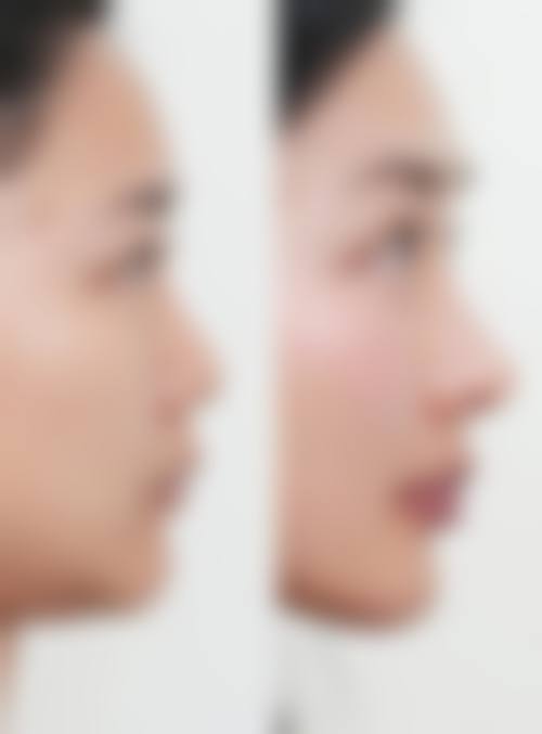 崔金珍医生专精的