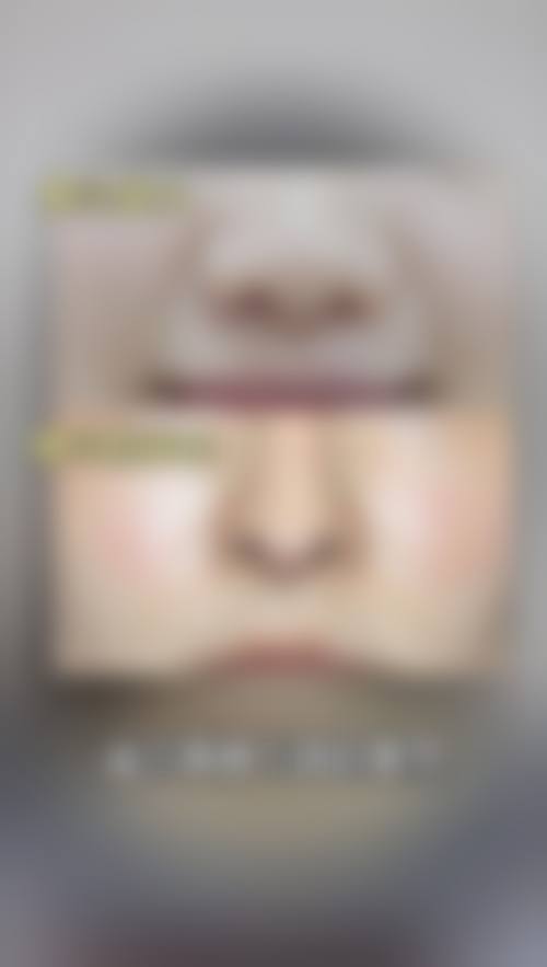 崔金珍医生覆盖的全品类医美服务项目