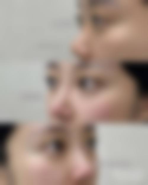 靳琦擅长的核心医美项目清单