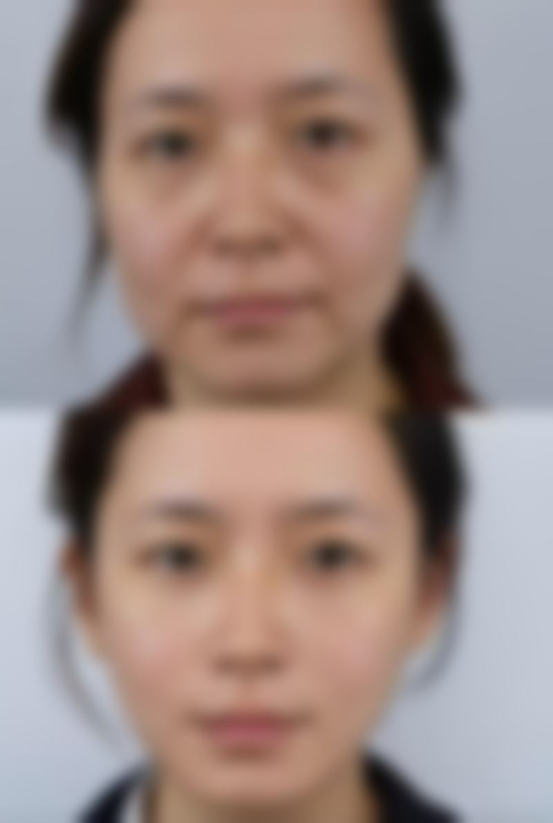 广州星团整形美容机构求美者反馈