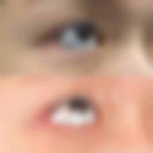 济南爱容整形医院求美者反馈