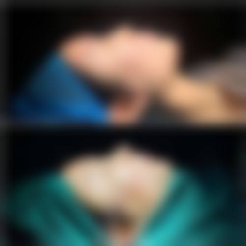 西安壹玖瑞娜整形医院价格收费