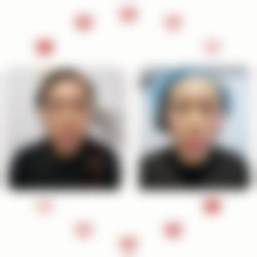 葫芦岛新铭医医学美容诊所求美者反馈