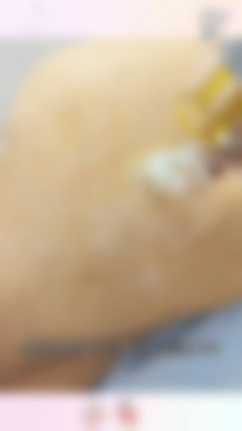 陈春松医生的技术优势：安心与成效并重