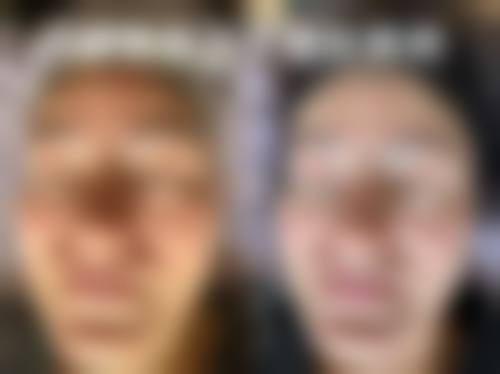 哈尔滨熙一娅整形医院特色项目及技术优势