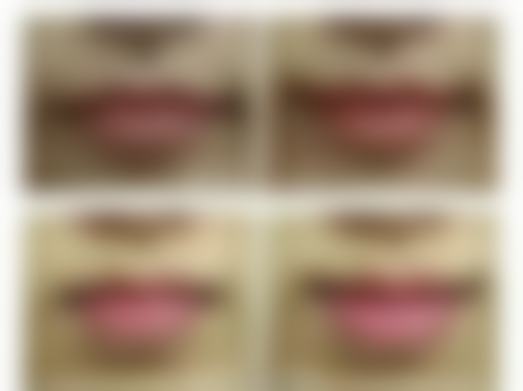 广州康华清医学美容医院价格收费