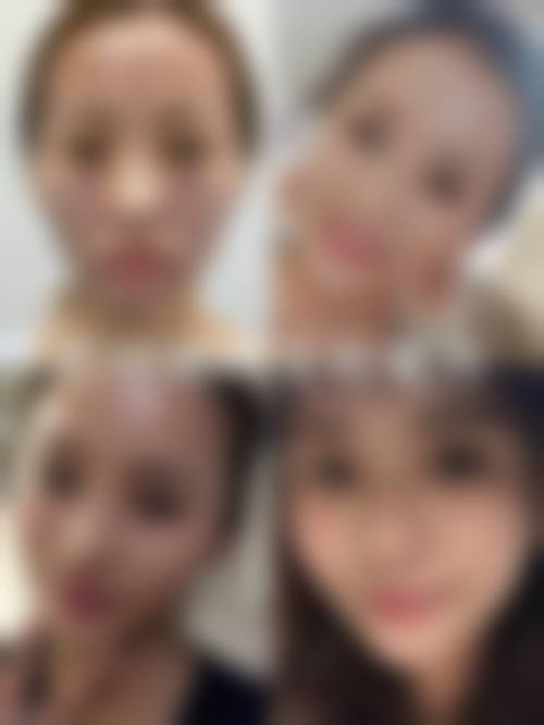 韩国珍爱整形医院特色项目及技术优势