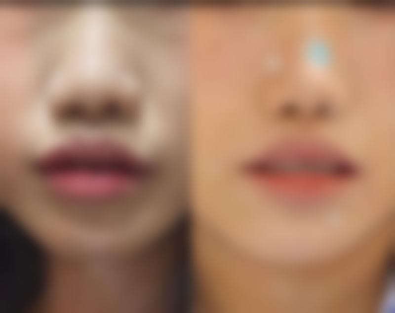 永州博美整形美容医院求美者反馈