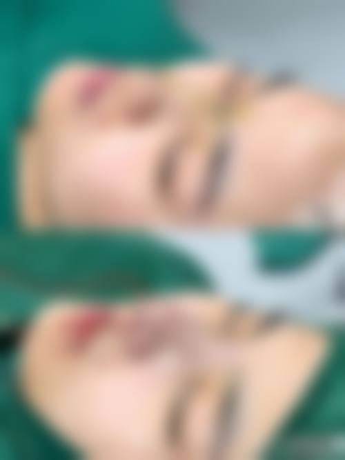 韩国林克整形外科求美者反馈