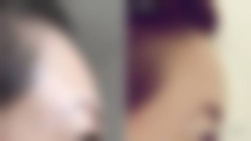 淮安市第一人民医院烧伤整形科特色项目及技术优势