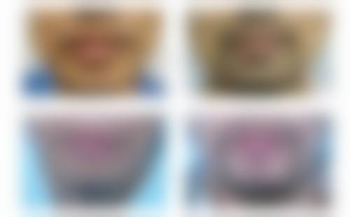 厦门湖里百星植发医生团队实力