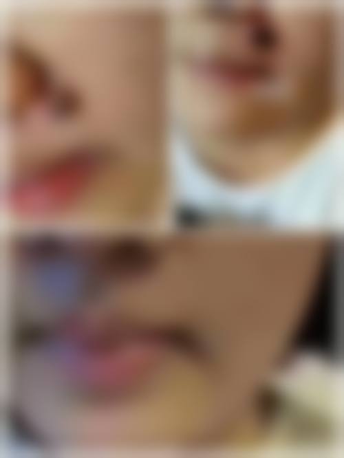 刘炜娟医生的临床诊疗优势