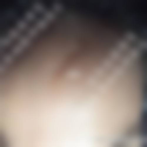 厦门湖里百星植发特色项目及技术优势