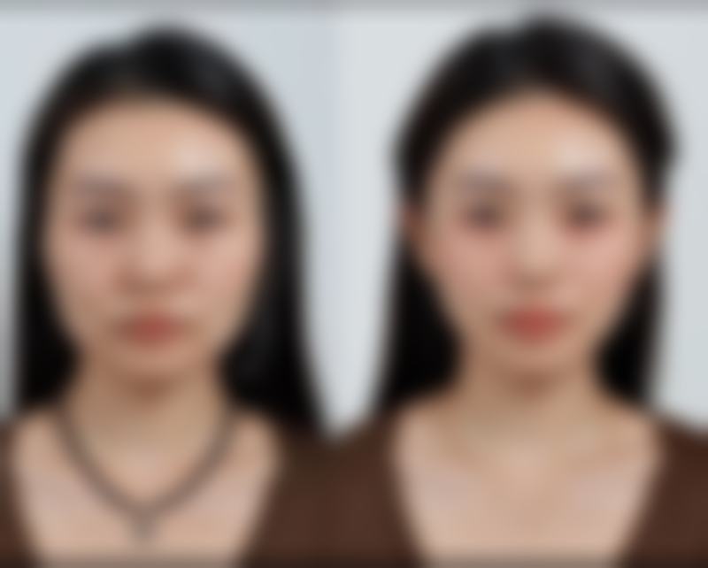 淮安市第一人民医院烧伤整形科医生团队实力