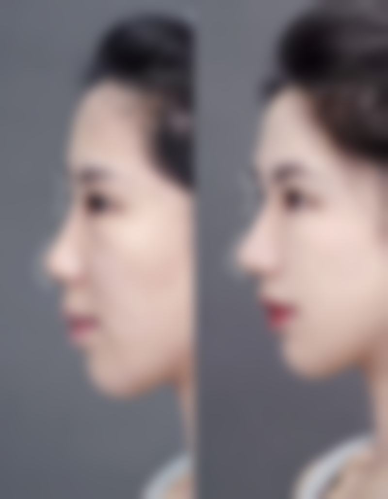 成都中清博澳整形医院特色项目及技术优势