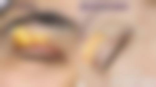 恩施中韩整形医院价格收费